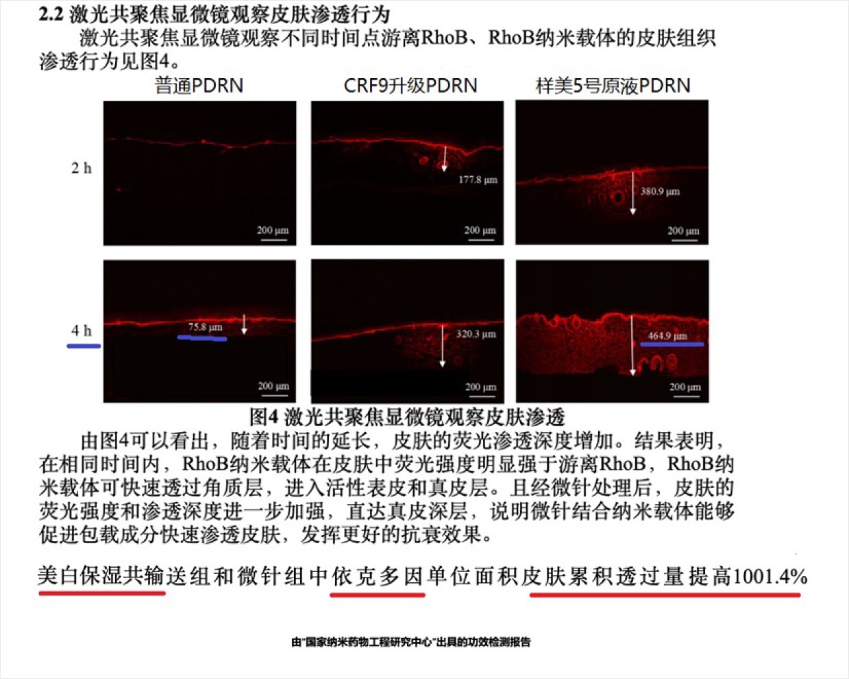 史上最全高端水光针动能素品牌详解 如何区别选择