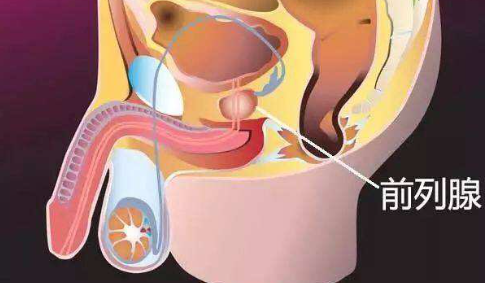 如何判断自己前列腺炎（怎么判断自己是不是前列腺炎）