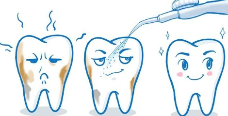 洗牙齿有什么好处和坏处（洗牙好处和坏处讲解）