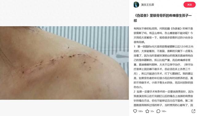 《伪装者》女主自曝被胡歌砸断锁骨：剧组封口不让外传