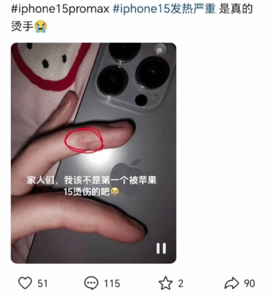 iPhone15 Pro发热到没法用：有小姐姐大腿被烫伤